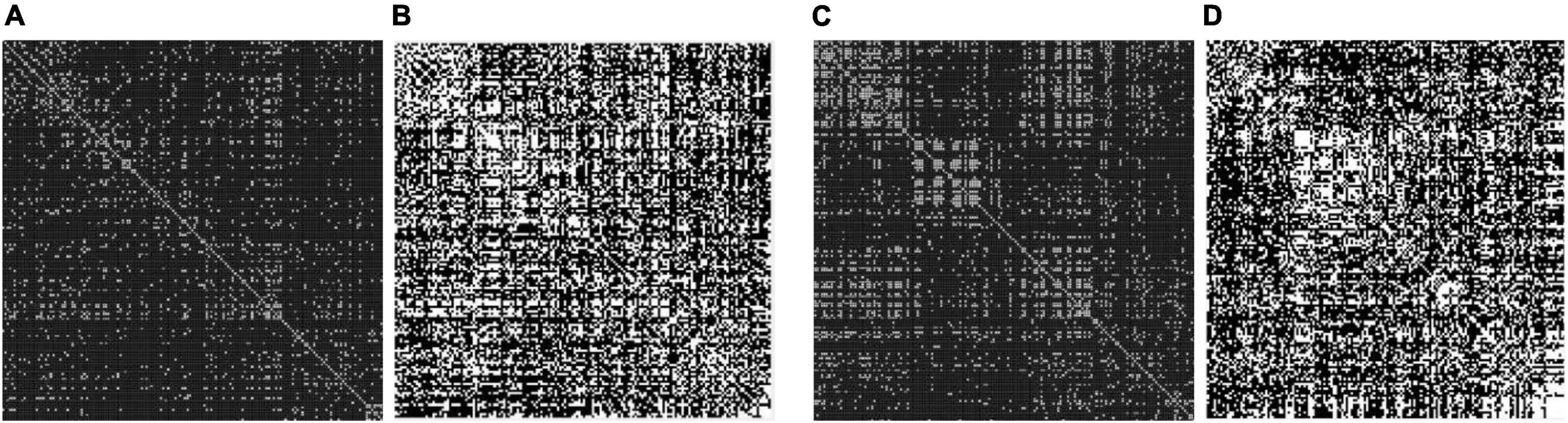 The classification of brain network for major depressive disorder patients based on deep graph convolutional neural network
